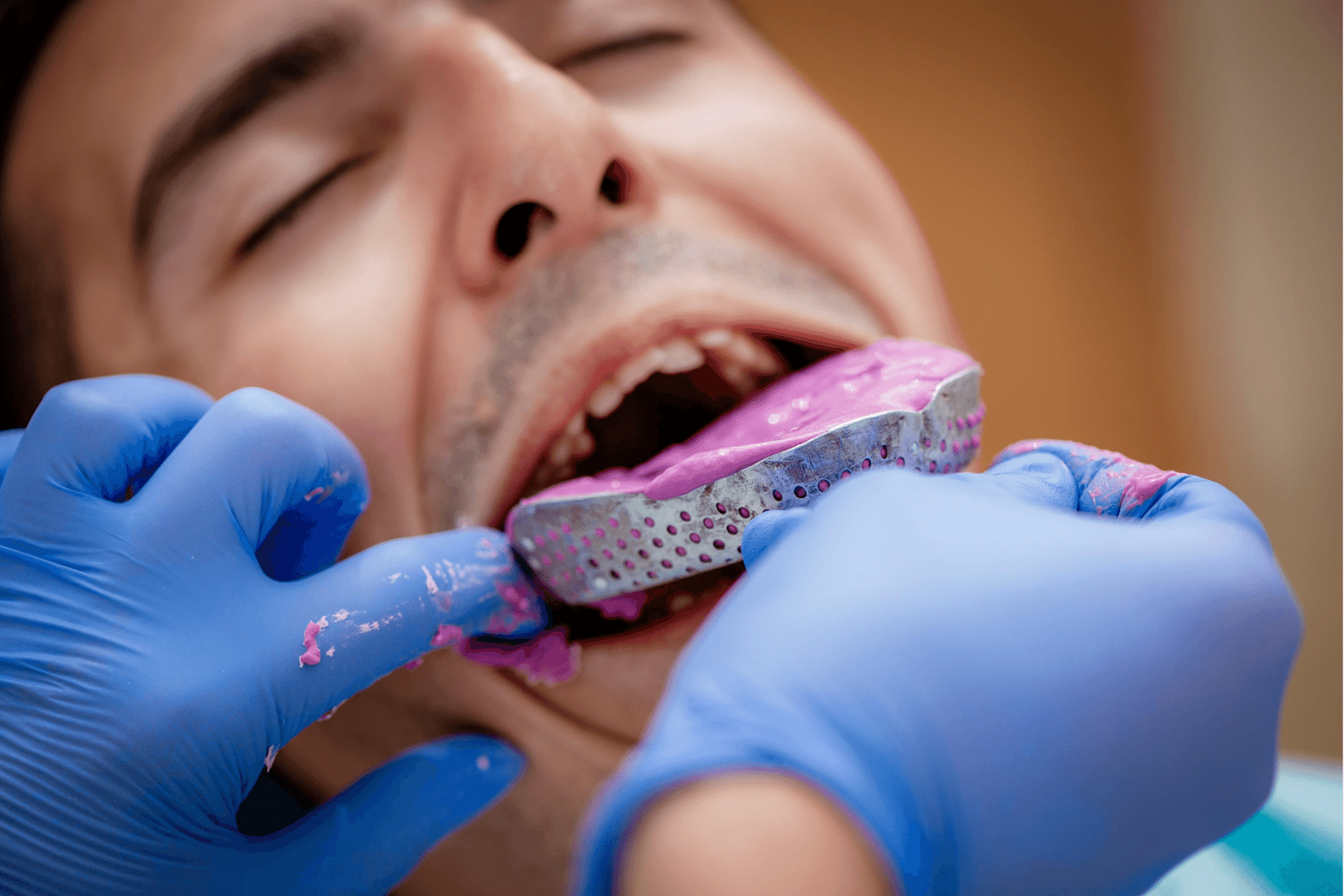 Способы реставрации зубов: как сделать зубные протезы в домашних условиях